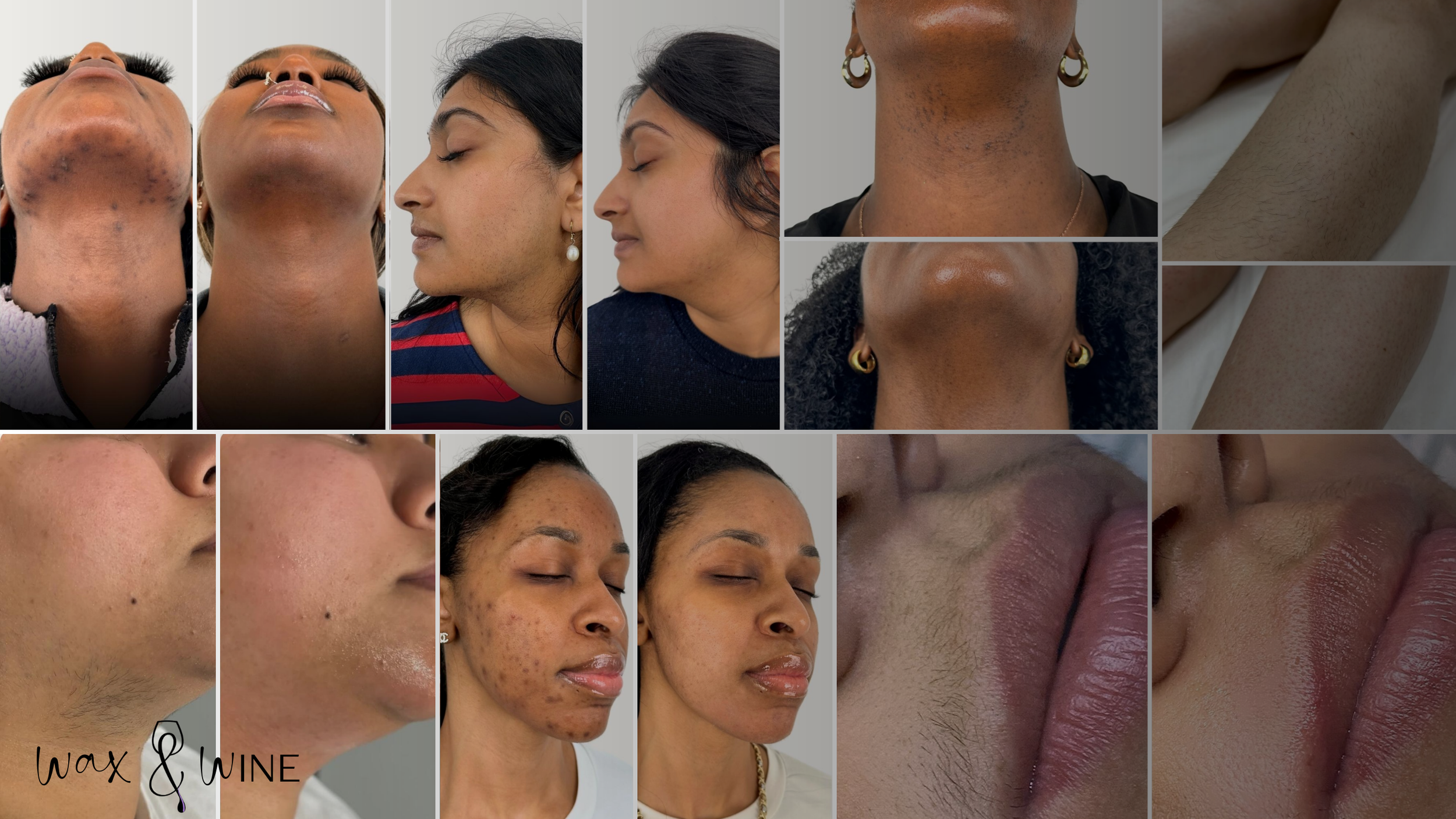 Compilation of close-up images showing different skin types, acne, scars, and lips, with some featuring women with diverse skin tones and hairstyles.