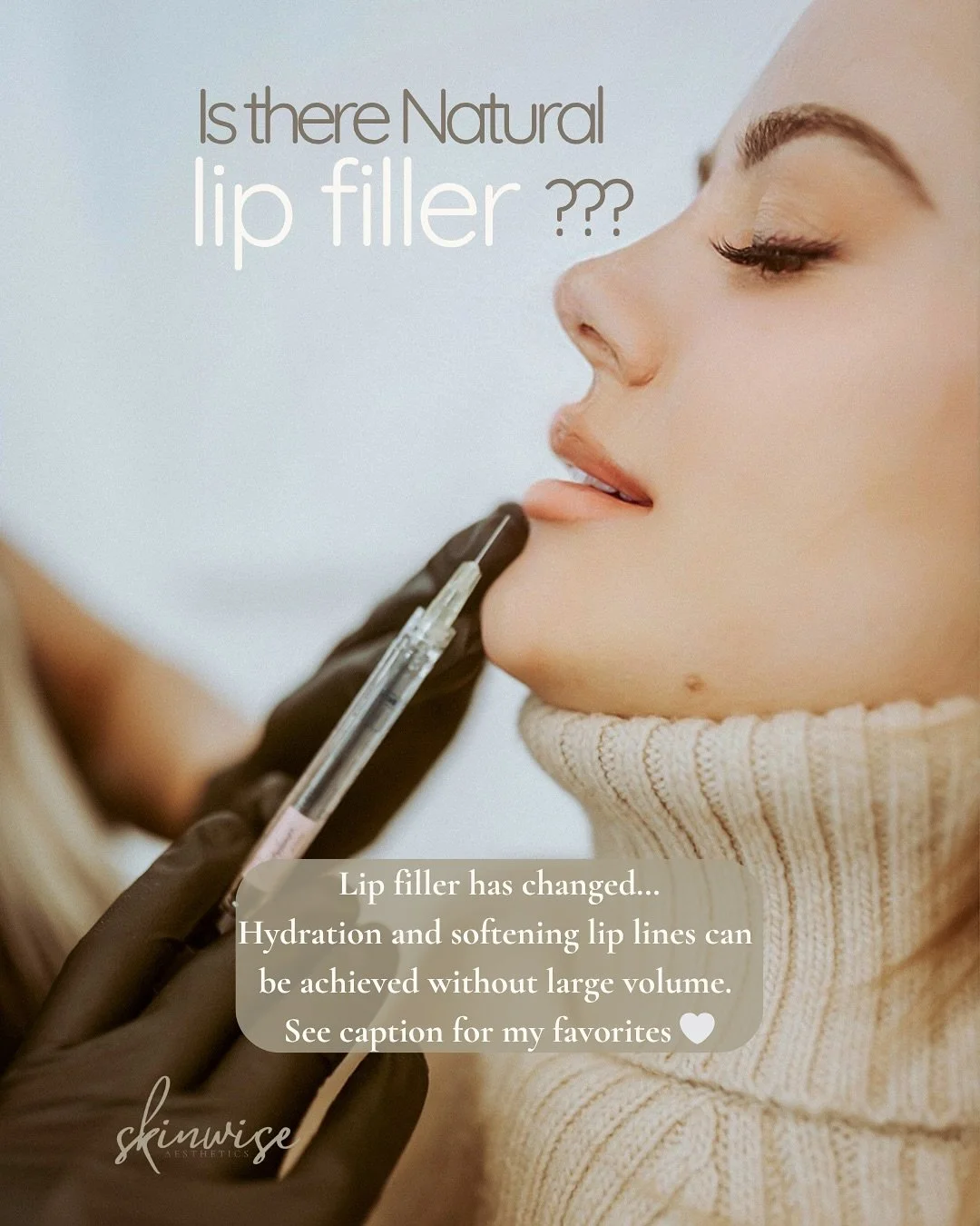 Natural doesn&rsquo;t mean no filler &mdash; it means the right filler, in the right way. 💯 

Every result depends on three things:
&bull; Filler type
&bull; Placement
&bull; Volume

Precision and restraint create elegance. ✨

My favorite natural re