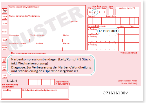 Beispiel Narbenkompression