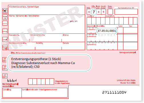 Beispiel Erstversorgungsprothese