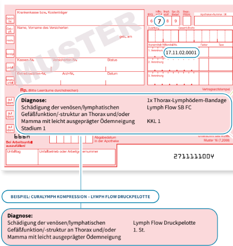 Beispiel Lymph Kompression und Druckpelotte