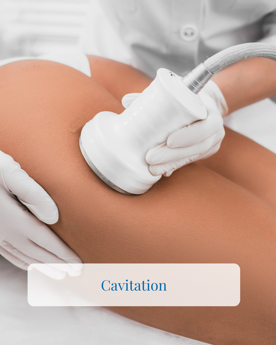 Cavitation Therapy