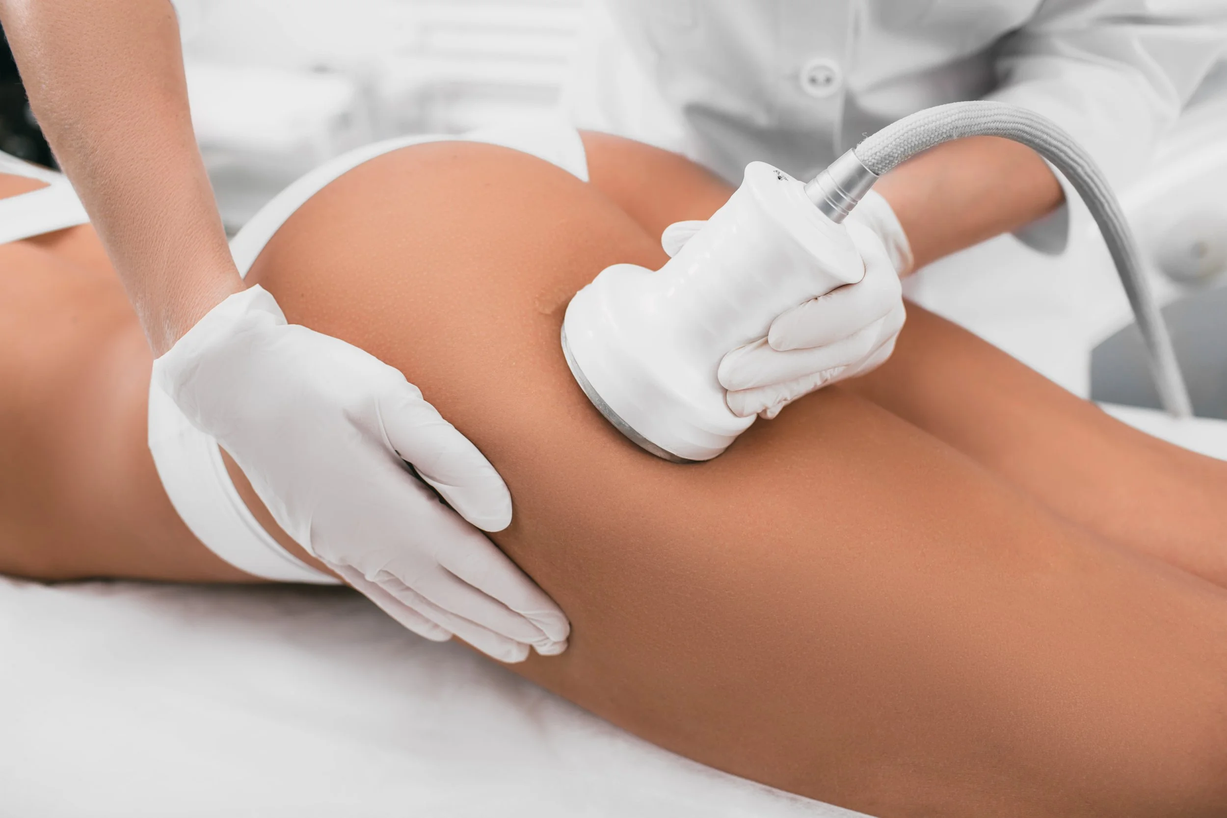 A person receiving a radiofrequency skin tightening treatment on their thigh in a medical clinic.