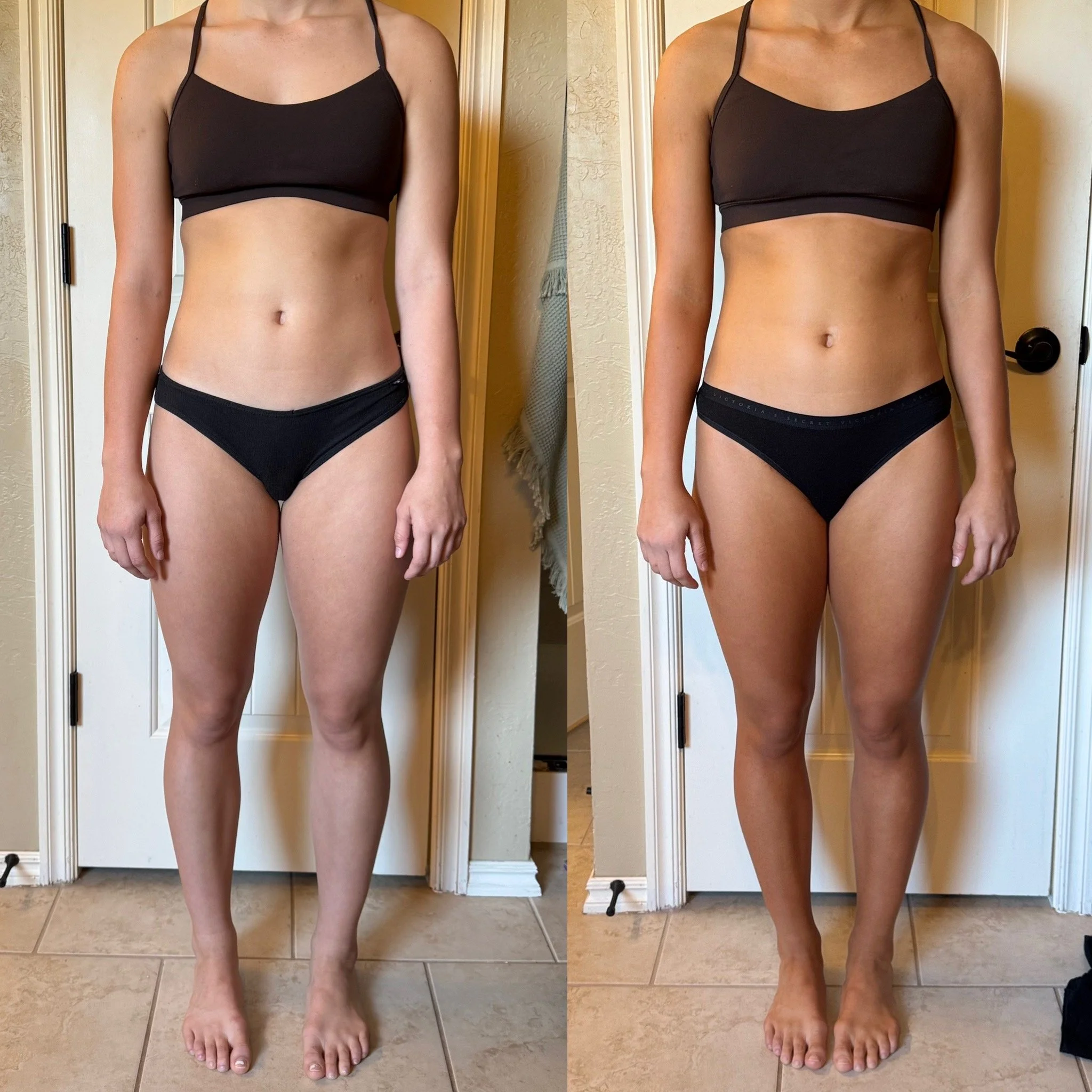 Before / After Glo it Forward