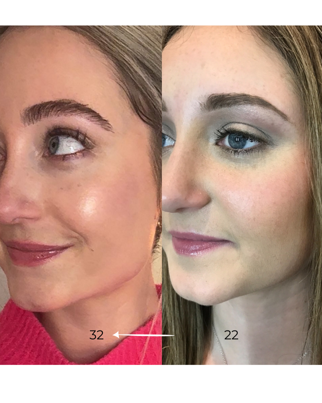 How I Keep My Skin Healthy at 32 (and Why I Look Younger Than I Did in My Early 20s — No Botox, No Filler)