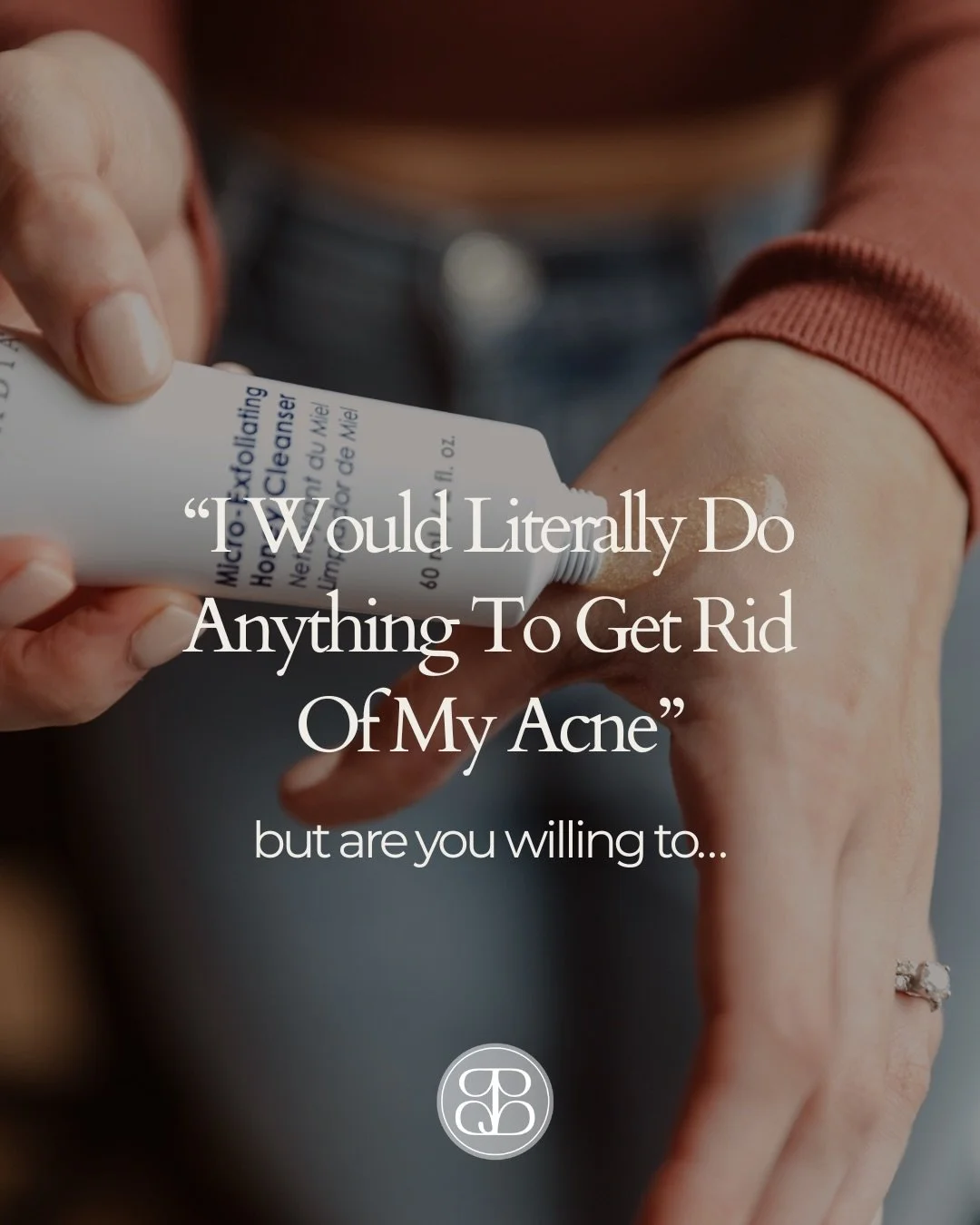 If you said yes to all of these, you&rsquo;re already ahead of most people 🩷
These are the things that actually make a difference when it comes to clearing acne, it&rsquo;s not just about what you&rsquo;re putting on your skin, it&rsquo;s everything