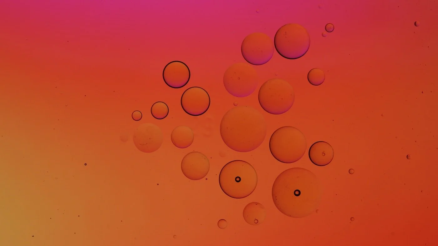 Inflammation-Related Anemia & Lupus