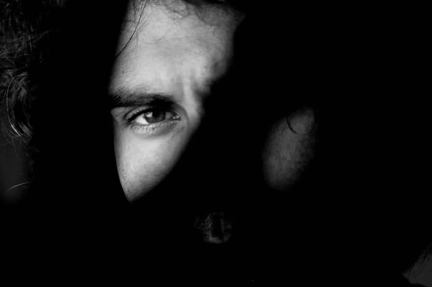 Moon Face, Facial Swelling, and Lupus