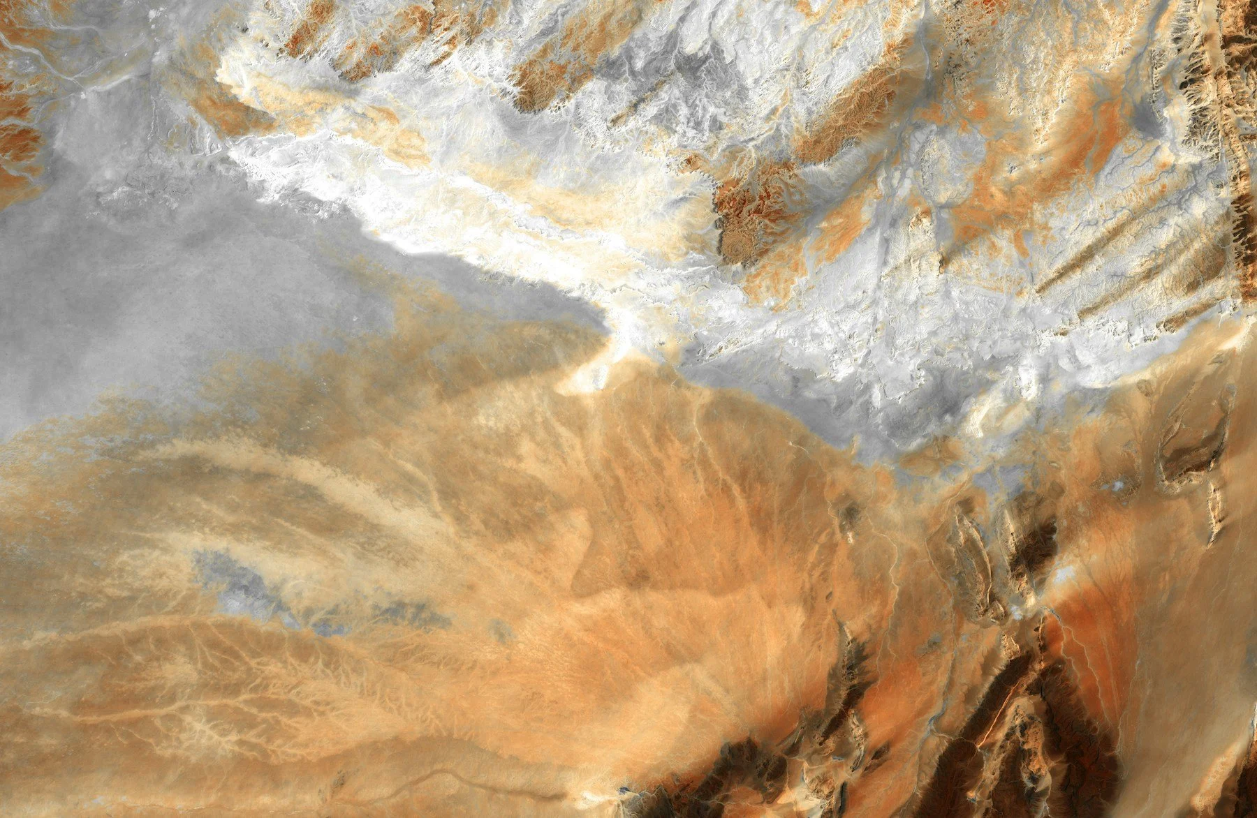 Xerostomia, Dry Mouth, and Lupus