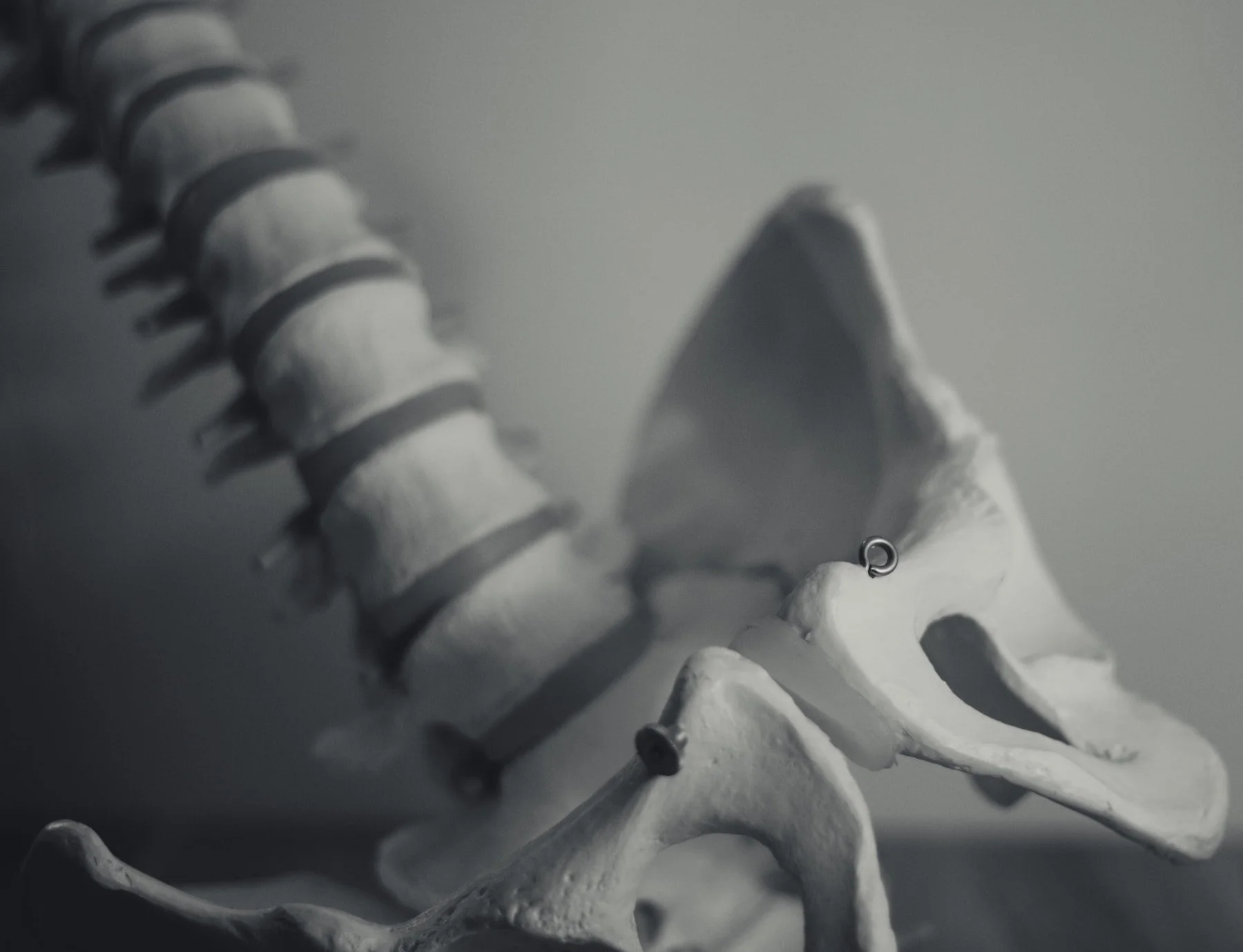 Bone Marrow Therapy and Lupus