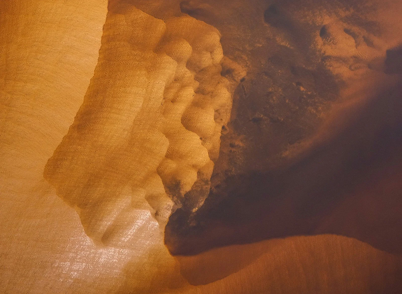 Calcineurin Inhibitors and Lupus