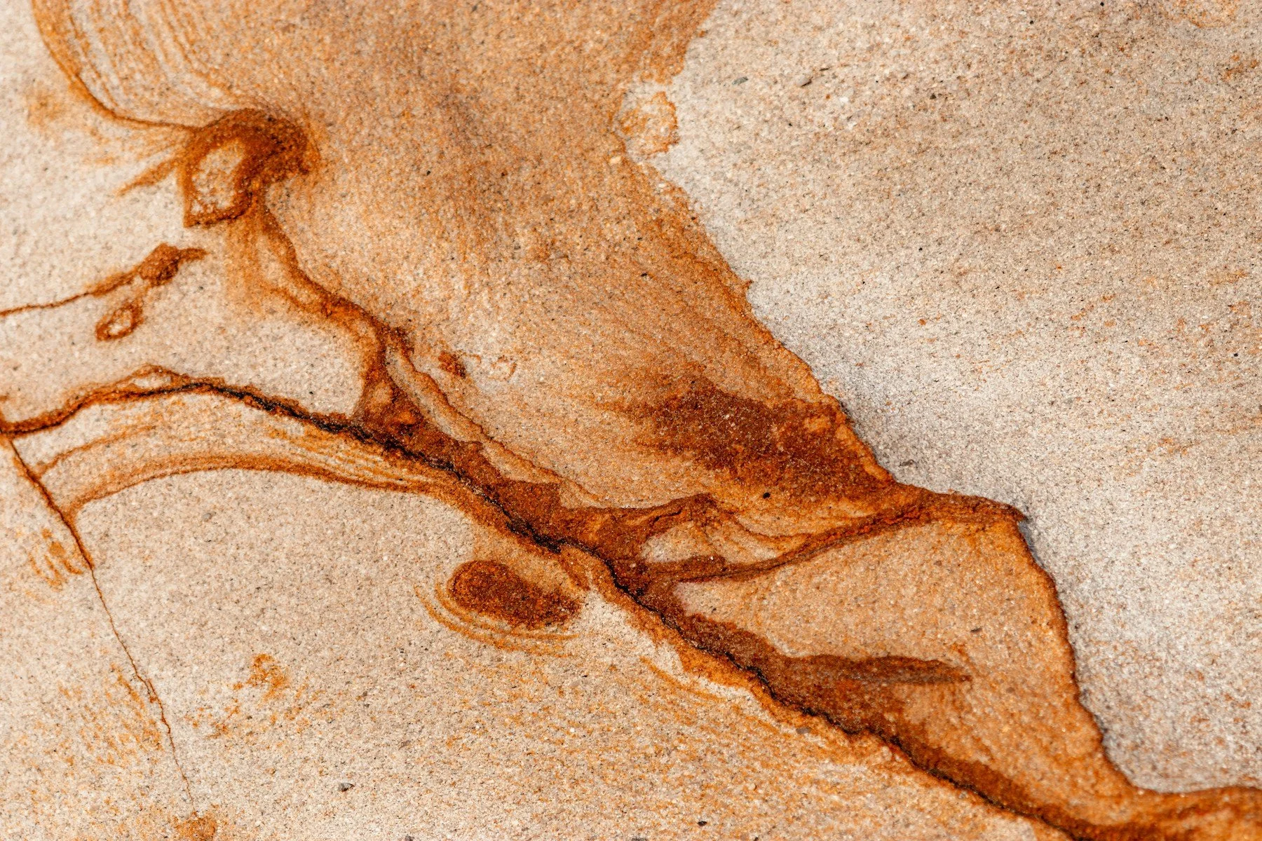 Hidradenitis Suppurativa and Lupus: Is there a link?