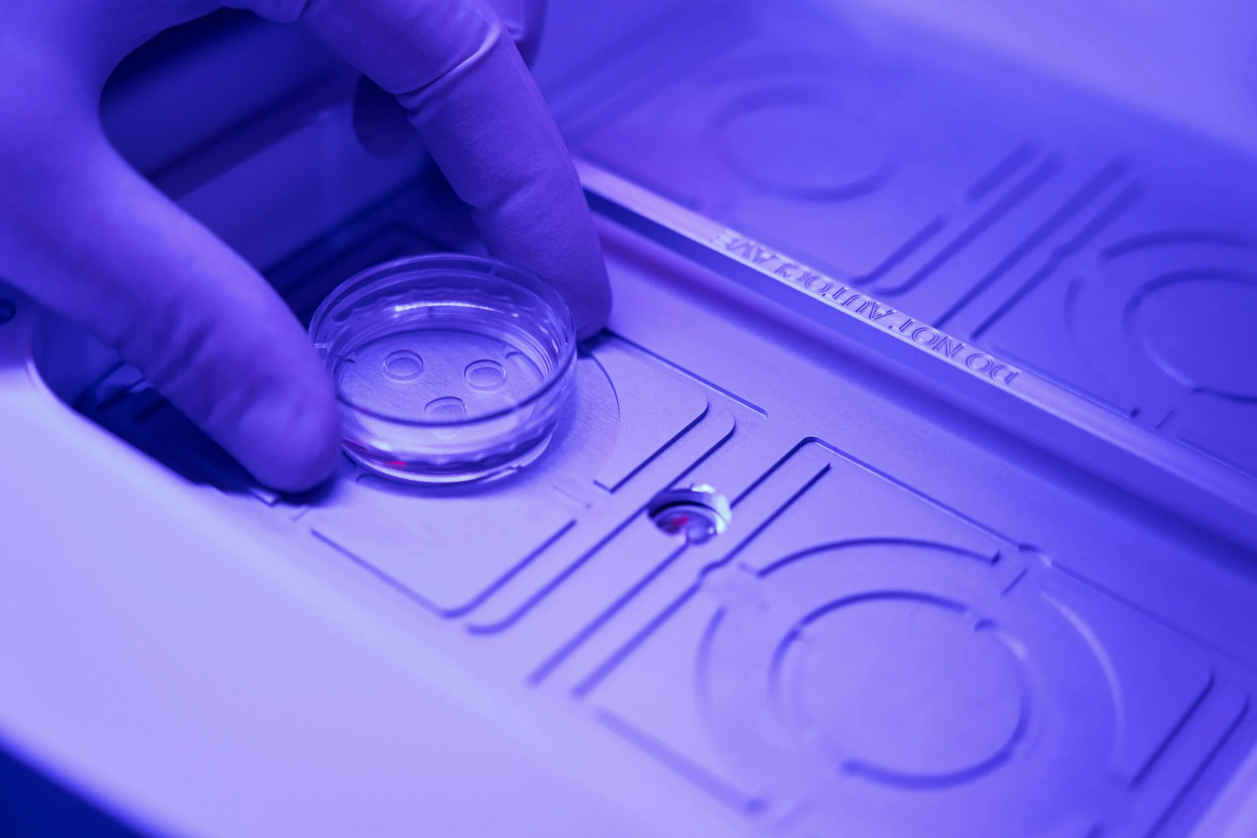CAR-T Cell Therapy and Lupus