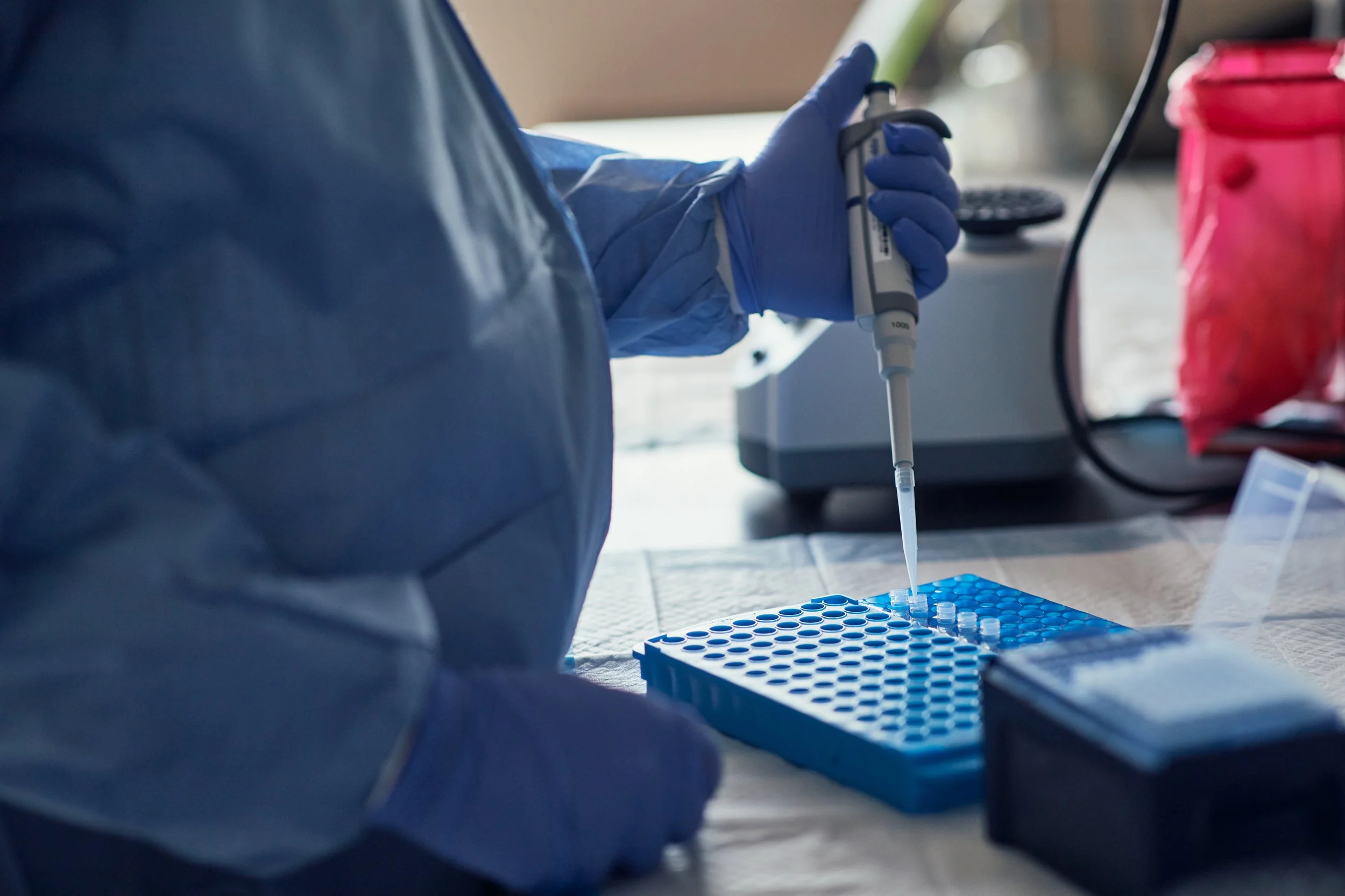 Blood Tests for Diagnosing and Measuring Lupus