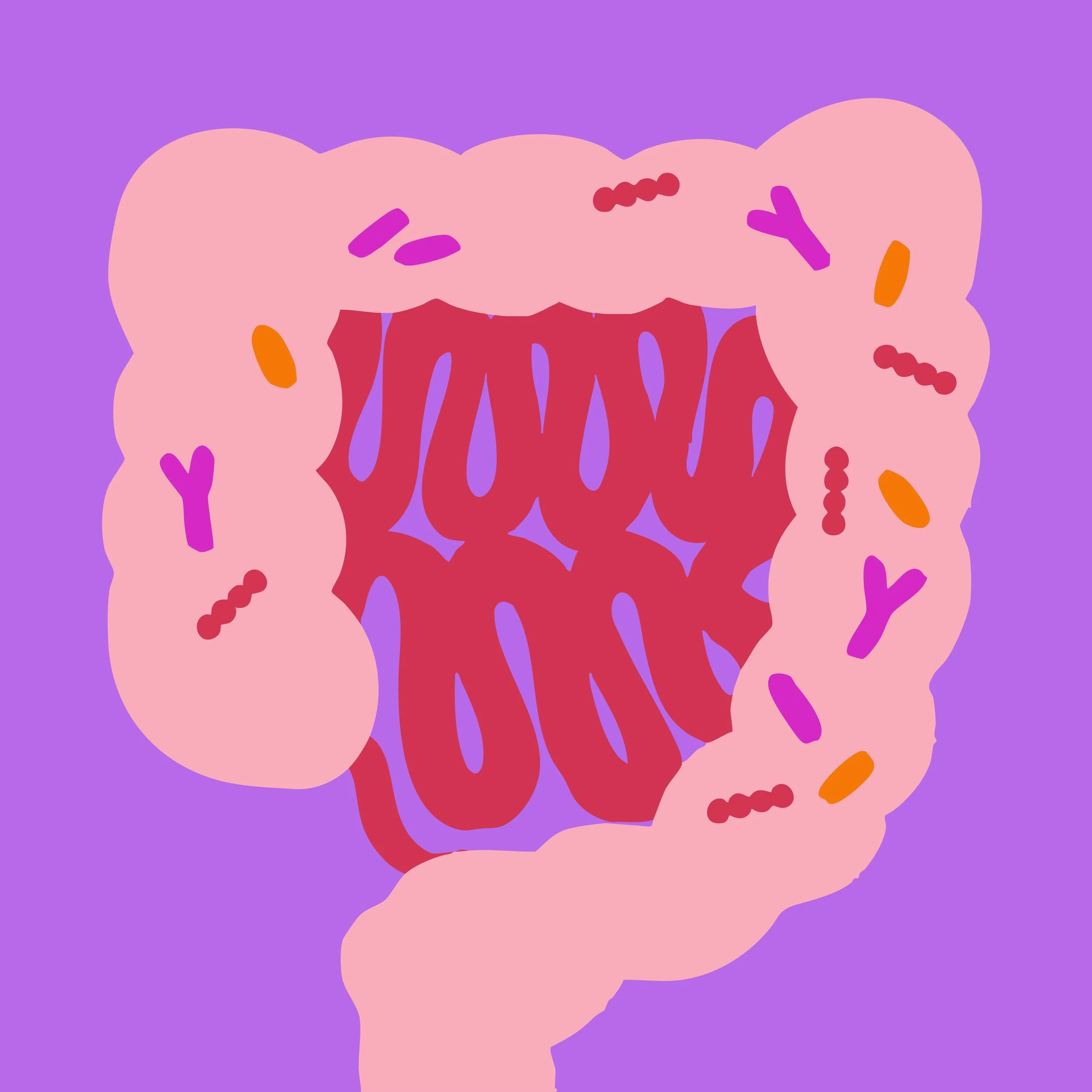 Gut Microbiome, Bacteria, and Lupus