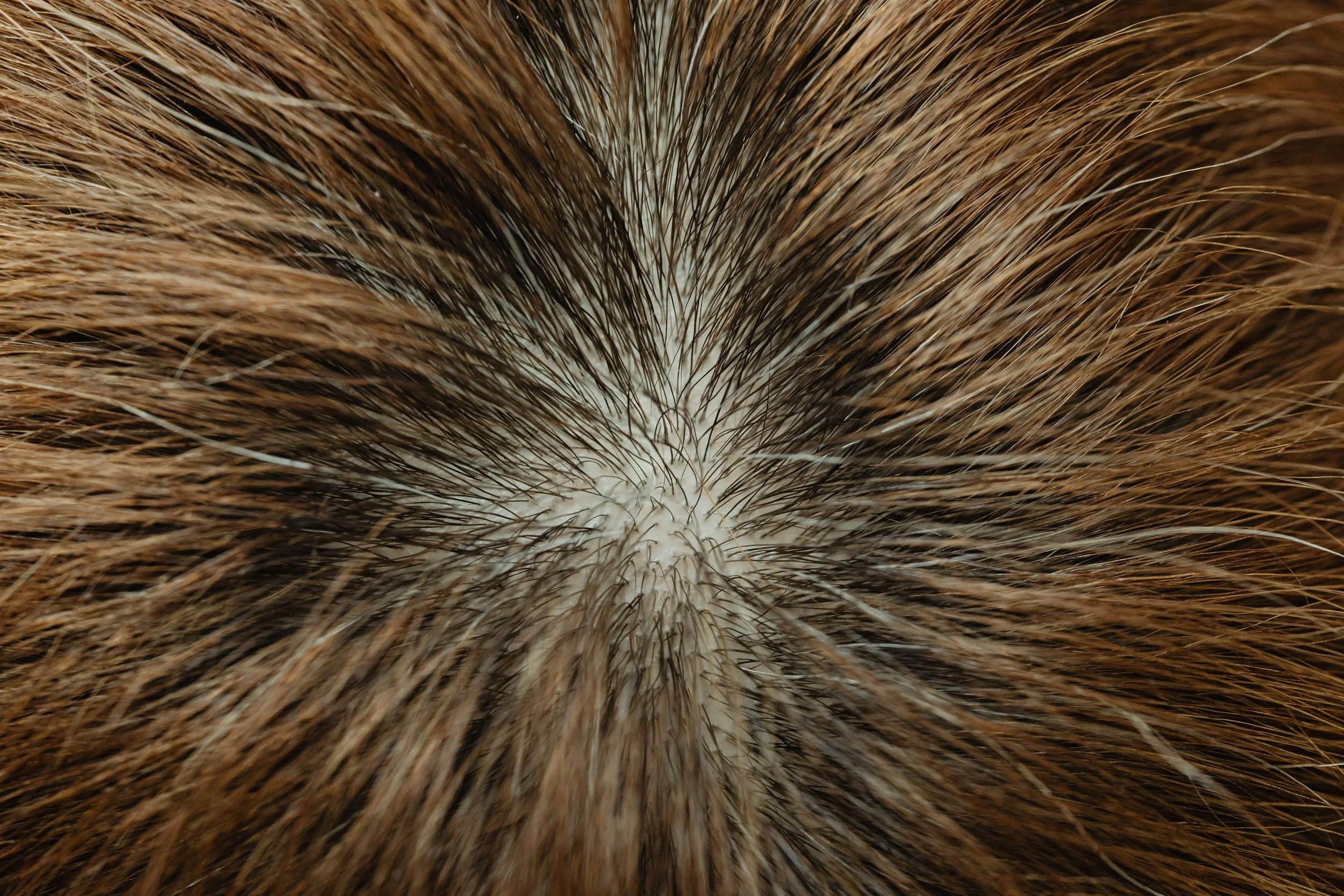 Brittle Hair, Scalp Care, & Treatments when Battling Lupus