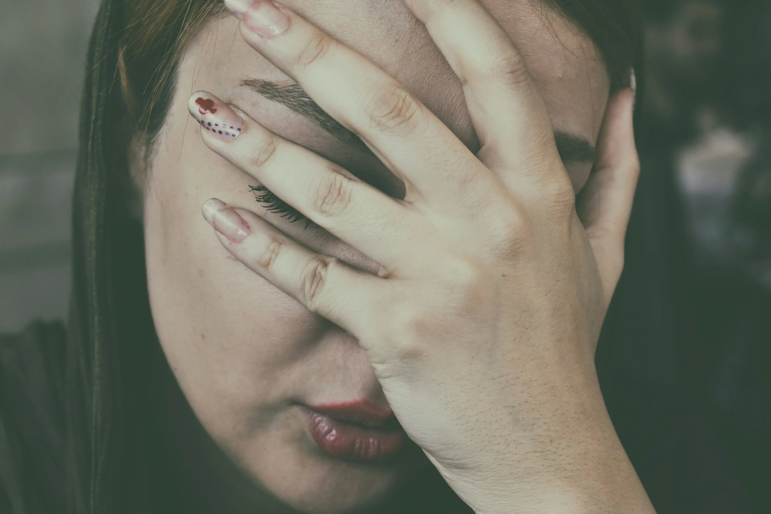 Lupus Headaches vs Migraines - What's the Difference?