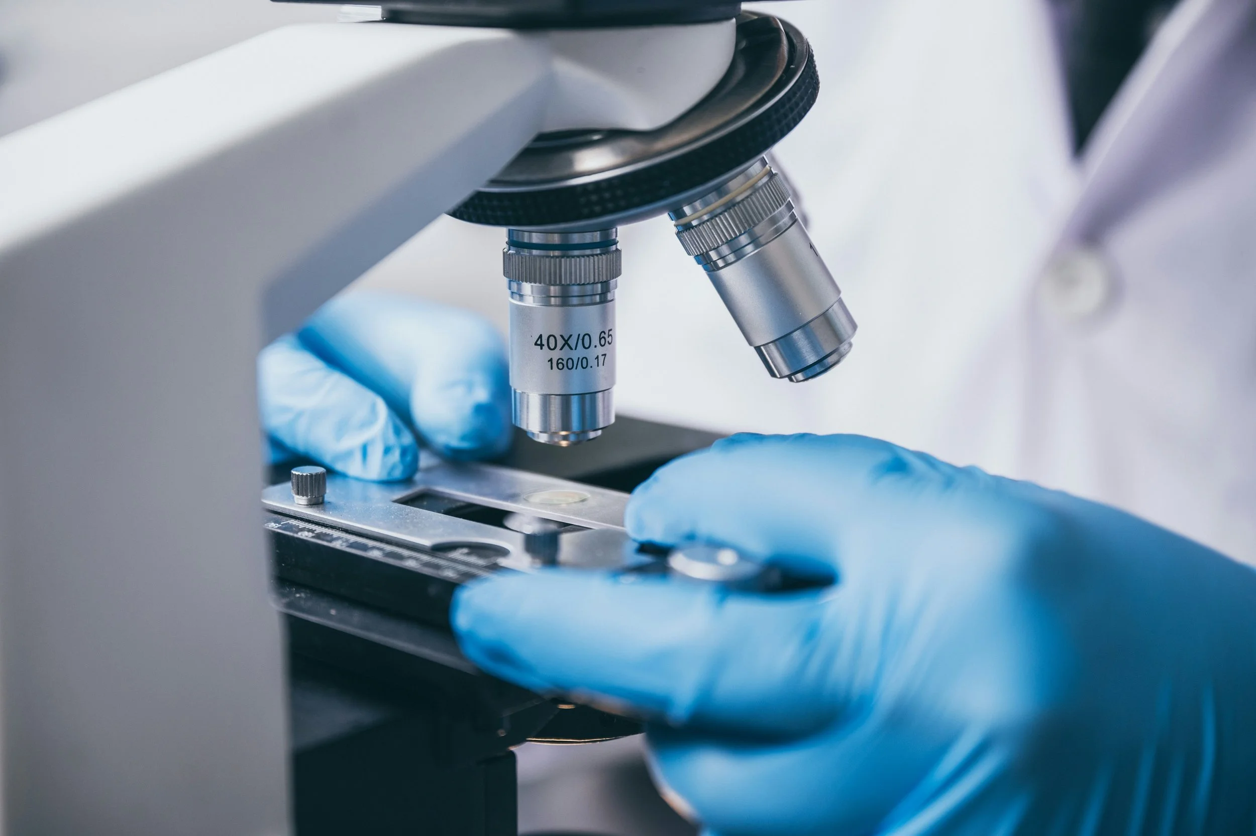 Lupus Research: Strategies & Methods