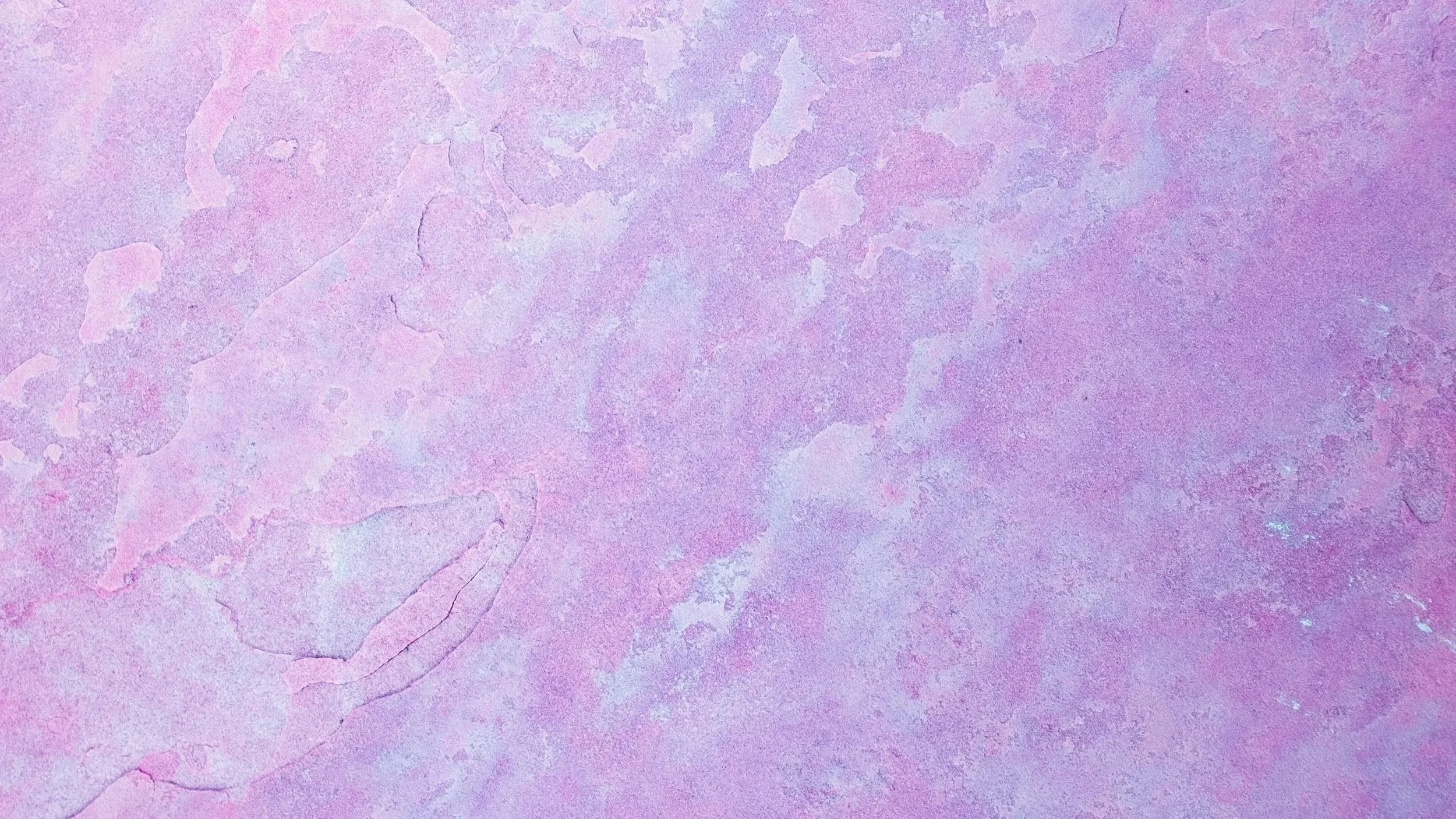 Lupus is... | Researching the Autoimmune Disease