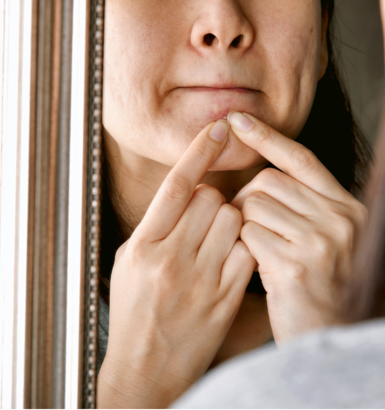 dermatillomania treatment nyc