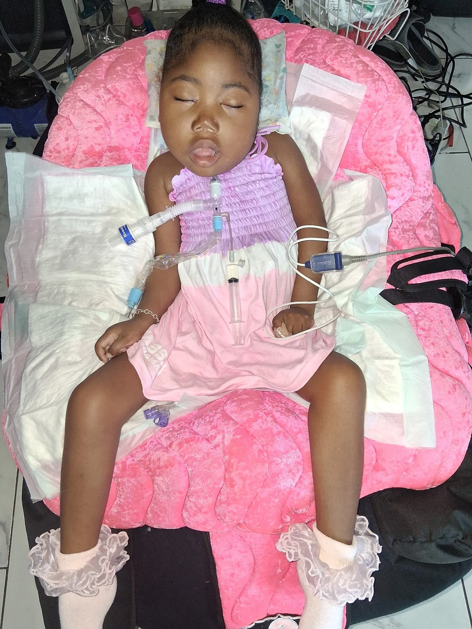 When Rare Becomes Real .. Understanding Jamaur Syndrome and Its Ripple Effects