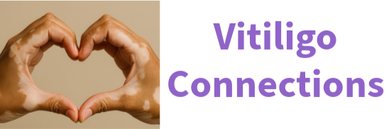 Vitiligo Connections