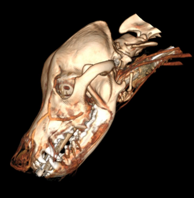 Tomografia Computadorizada