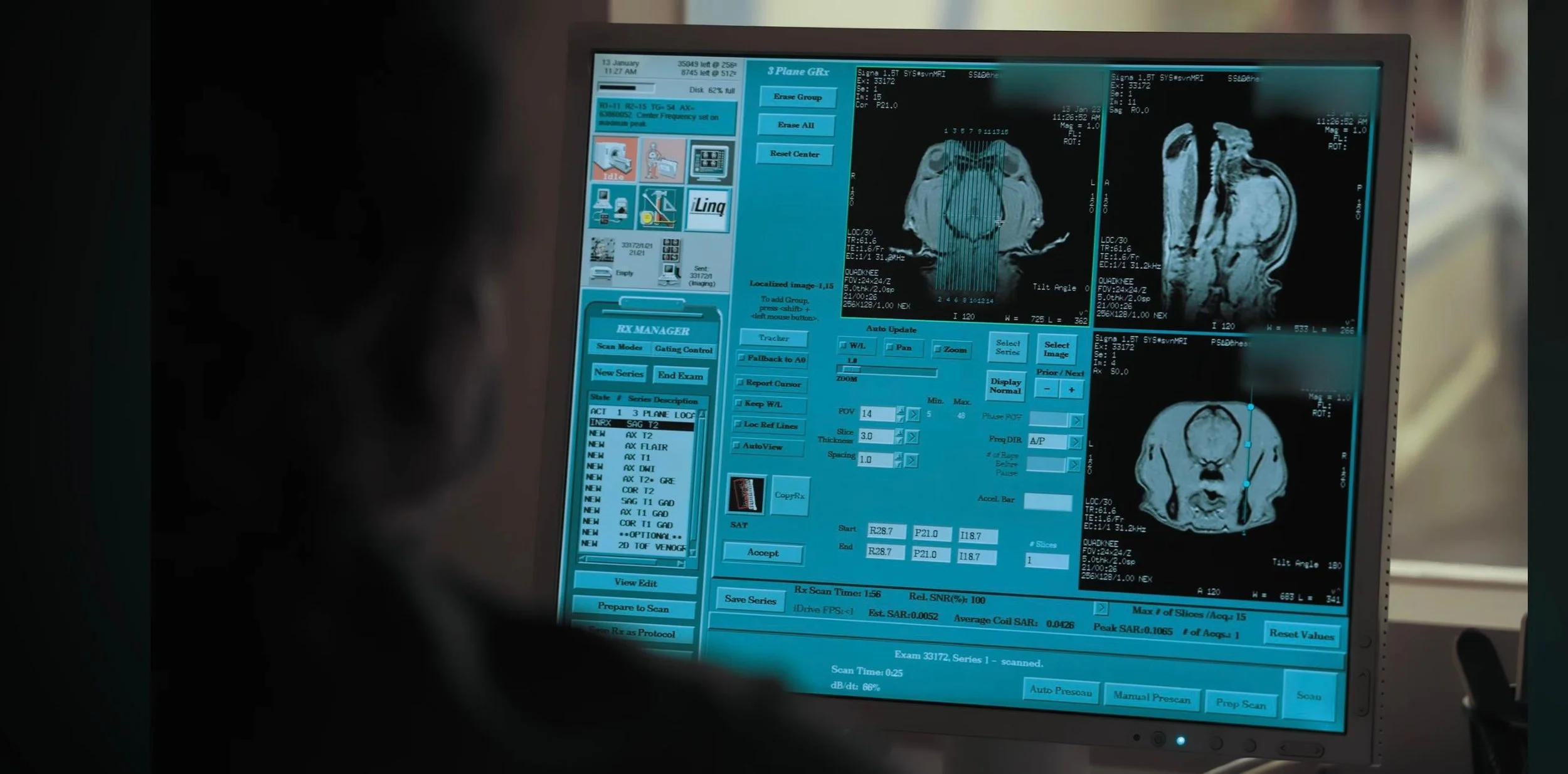 Tela de um scan de ressonância magnética cerebral exibindo várias imagens do cérebro em diferentes cortes junto com controles e dados técnicos na interface do software de exame.