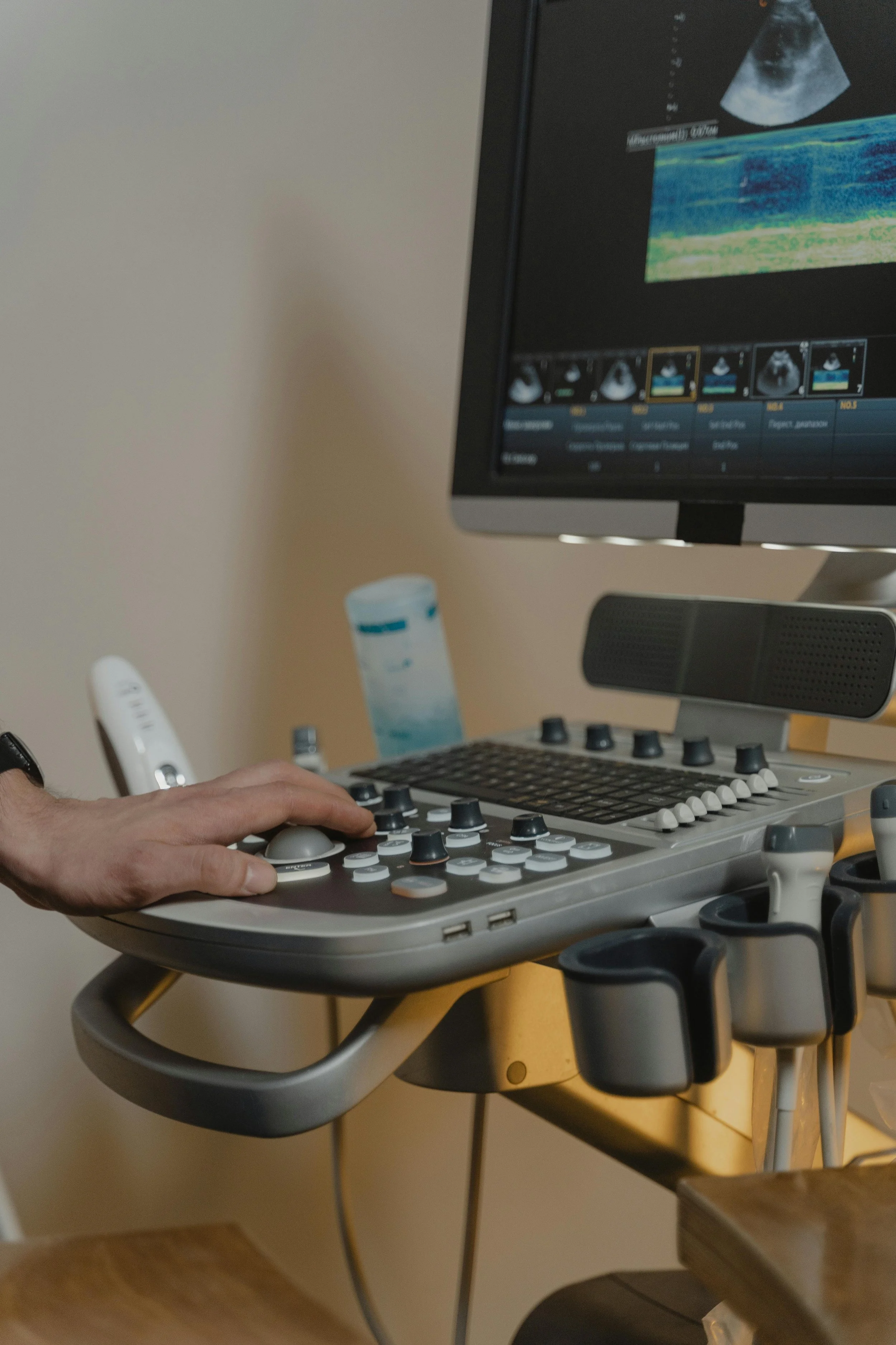 Medical ultrasound machine with a hand operating controls and a monitor displaying ultrasound images.