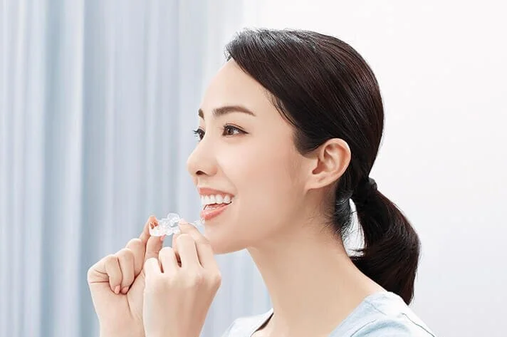 sg_wearing_aligner-8f69be7a2dc4a884ecf36ad8b3dfc086e74edf4ee538d93427ea174b9204d1db.jpg