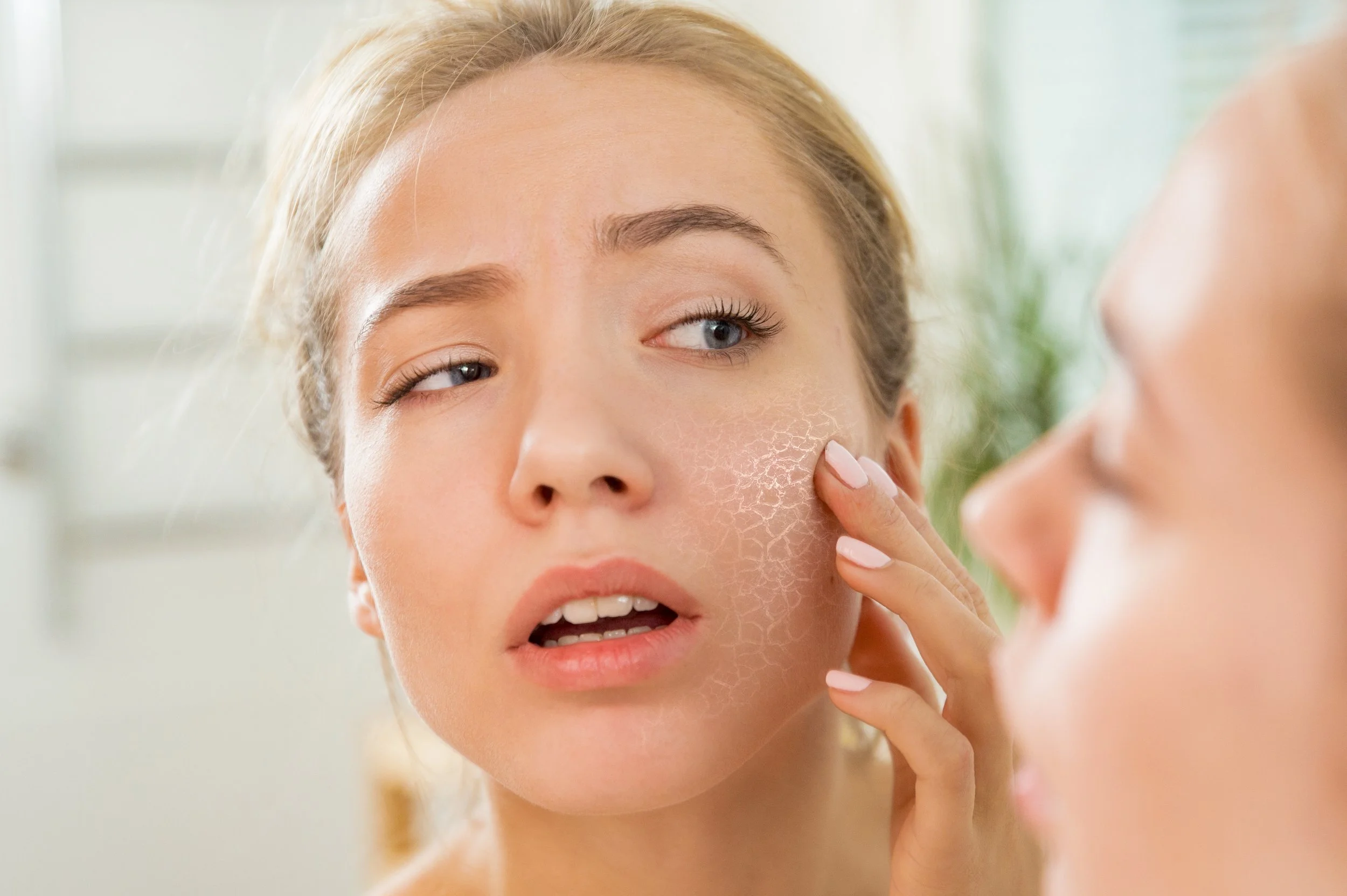 Woman applying moisturizer or treatment to dry skin on her cheek in front of mirror.