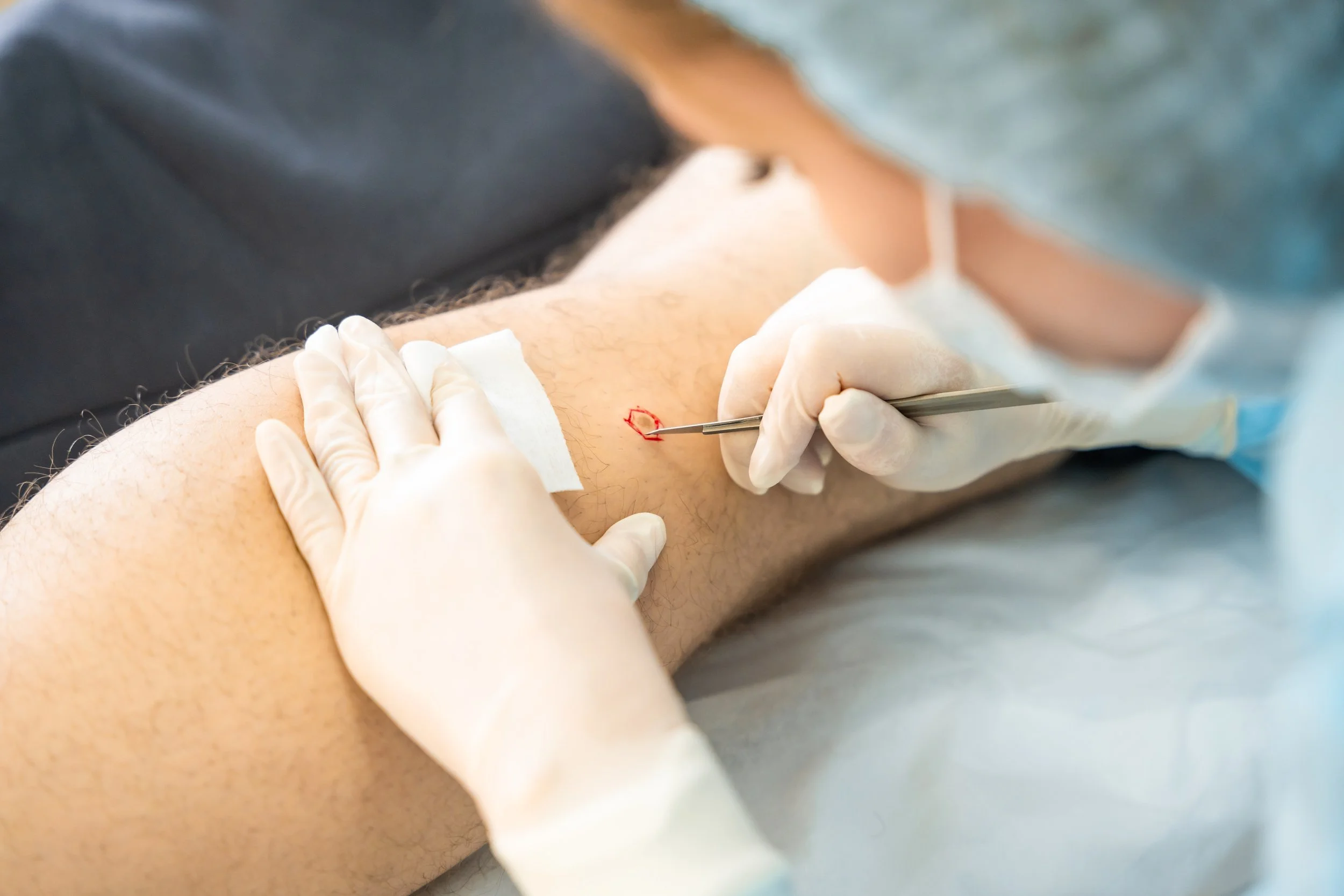 A healthcare professional wearing gloves and a mask is drawing blood from a patient's arm with a needle.