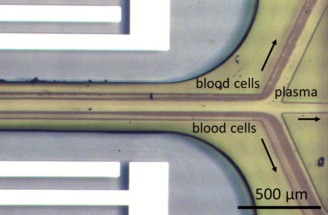 Microscopic image of a blood vessel showing blood cells and plasma, with a scale bar indicating 500 micrometers.