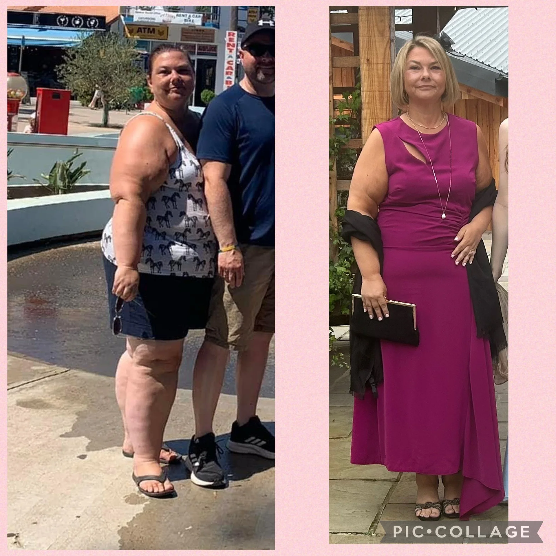 Side-by-side photos of a woman before and after a weight loss transformation. In the first photo, she is standing outdoors in casual summer clothing, and in the second photo, she is dressed elegantly in a magenta gown at an indoor event.