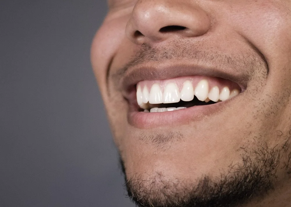Close-up of a person's smile showing white teeth and a slight mustache and beard