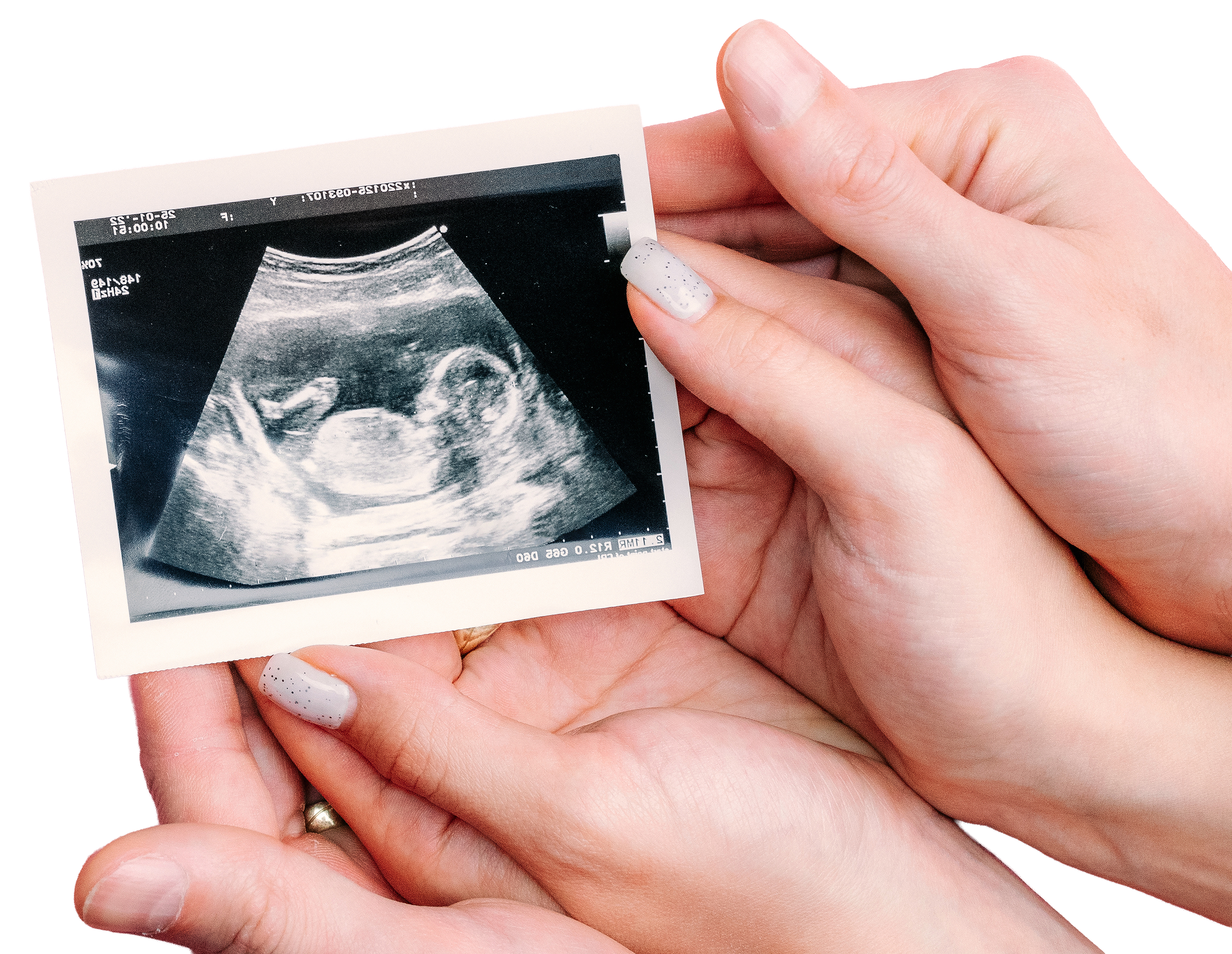 A couple cupping hands holding an ultrasound printout of a baby