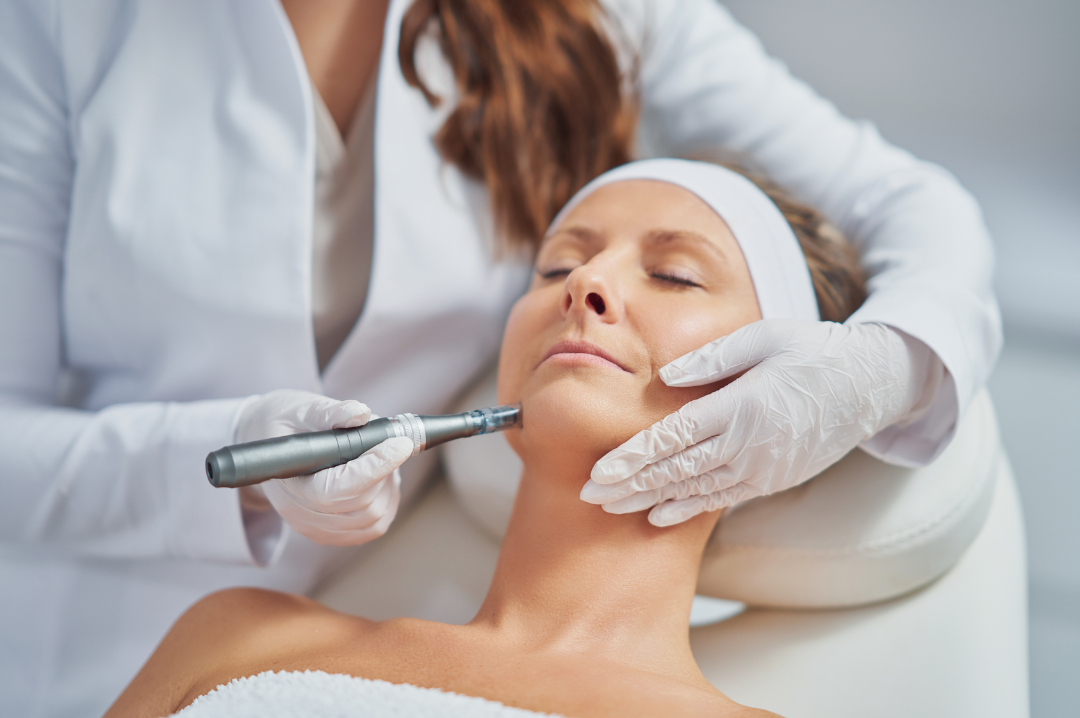Medspa in Statesville, NC, 28677  RF Microneedling Near Me.png