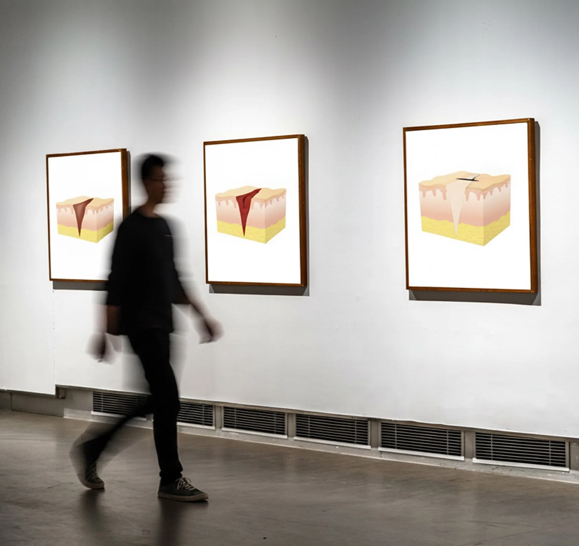Gallery wall showcasing anatomical illustrations of the stages of wound healing.