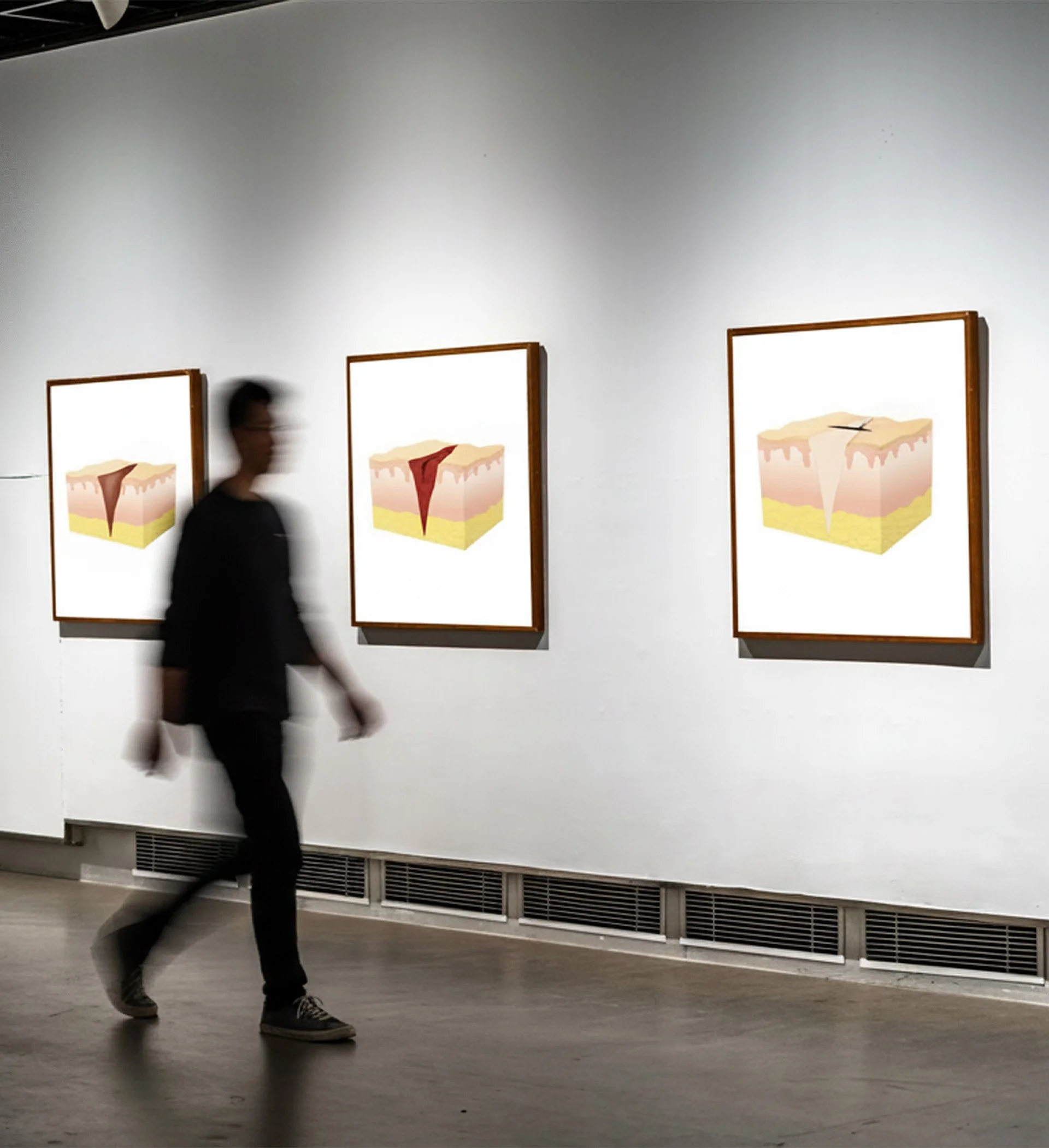 Gallery wall showcasing anatomical illustrations depicting various stages of wound healing.