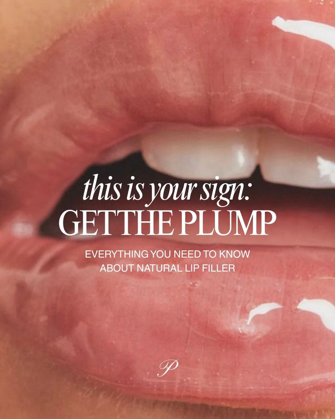 This is your sign
Get the plump&mdash;without the overdone look

We focus on natural, balanced, you-but-better results 🤍

Schedule your lip filler consult