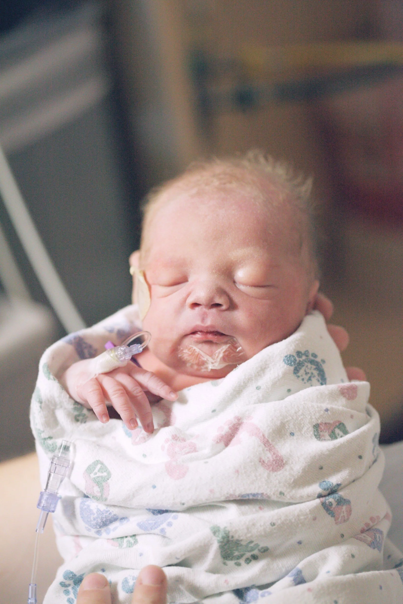 NICU “The Basics”