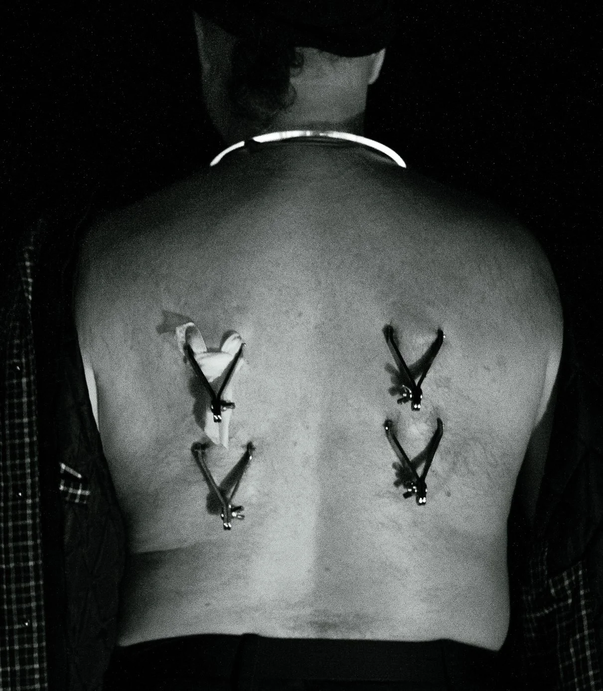 Person's back with four suspension hooks attached to their skin on the upper back.