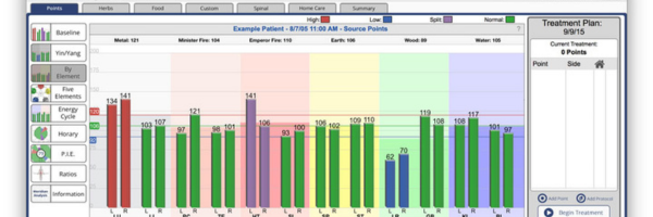 Discover How AcuGraph &amp; Acupuncture Work Together to Improve Health