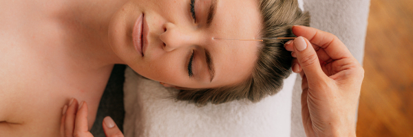 How Acupuncture Relaxes the Nervous System
