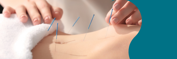 5 Ways Acupuncture Supports Your Fertility Journey