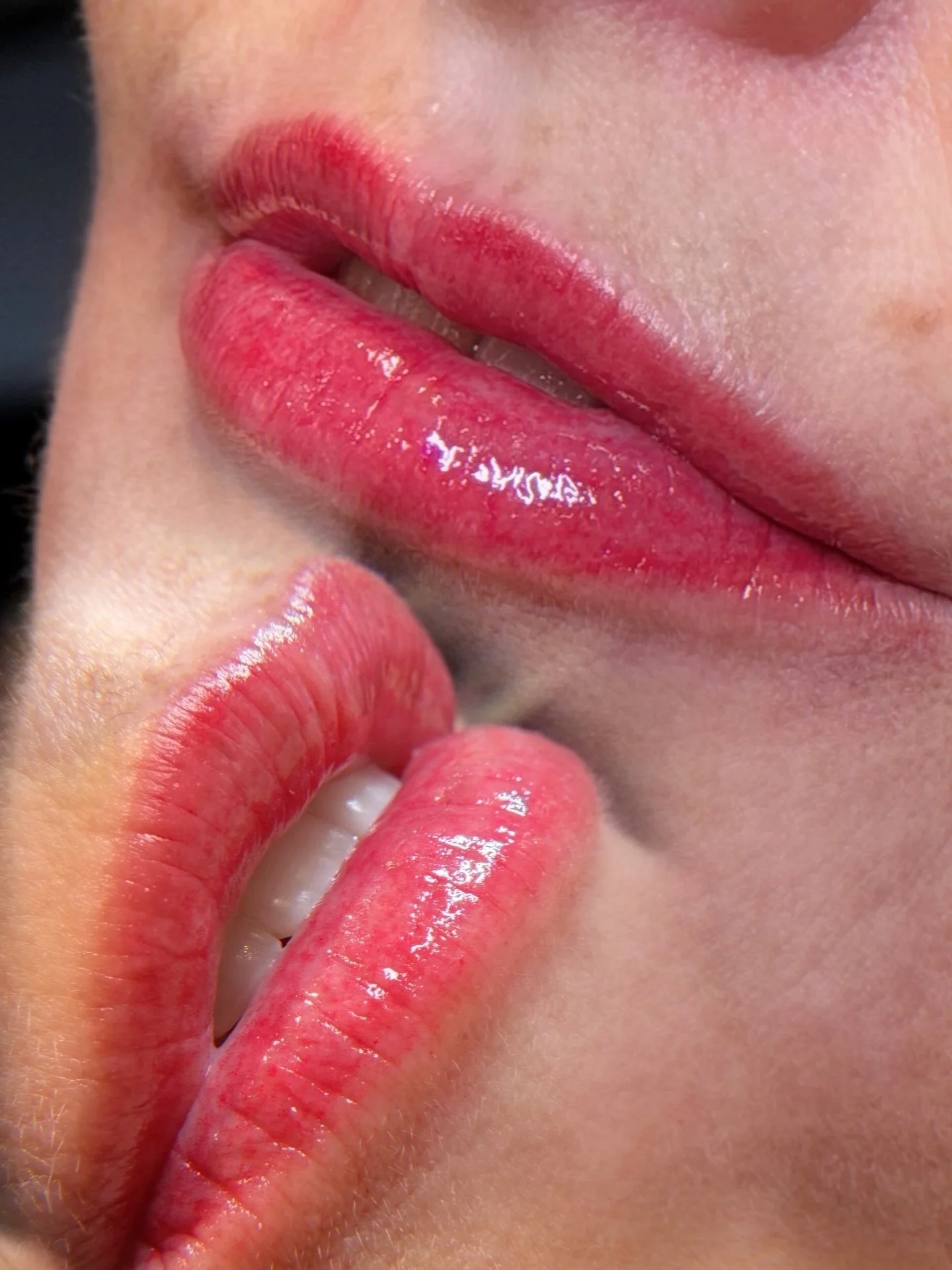 Flawless, tinted lips &mdash; no liner, no smudge, no effort 💋
Now through January 1, enjoy our Lip Blush Holiday Promo:
✨ Just $350 (originally $650!)

It&rsquo;s the perfect time to schedule and wake up with naturally enhanced, blushed lips every 