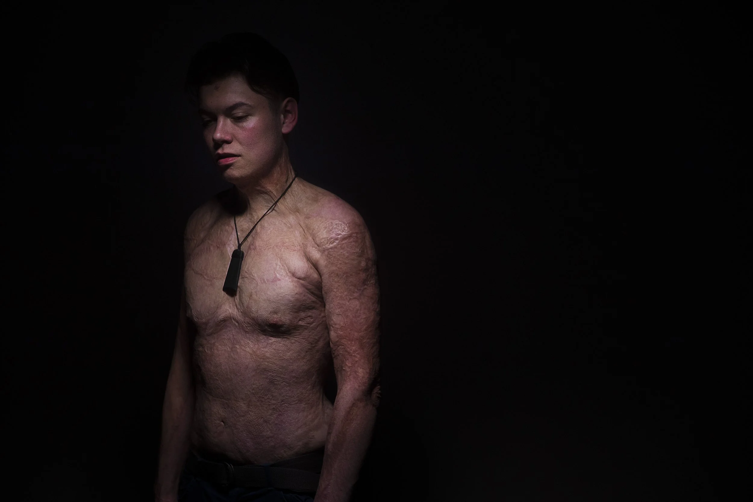 A shirtless person with textured, rough skin and scars, wearing a black necklace with a rectangular pendant, standing against a dark background with their eyes closed.