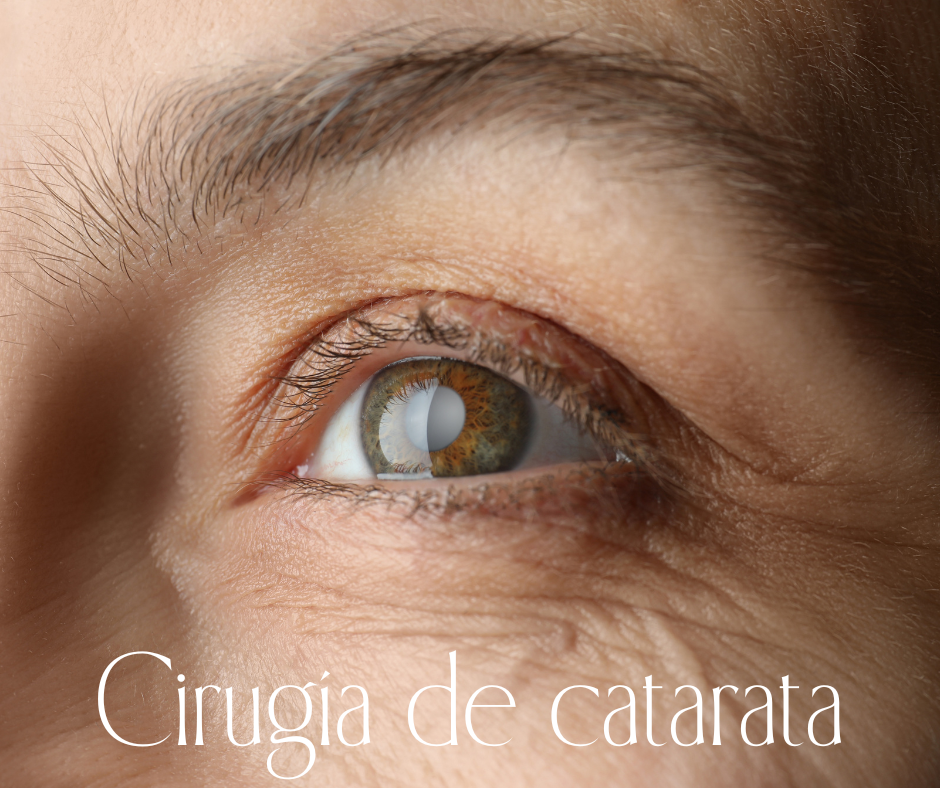 CIRUGÍA DE CATARATA
