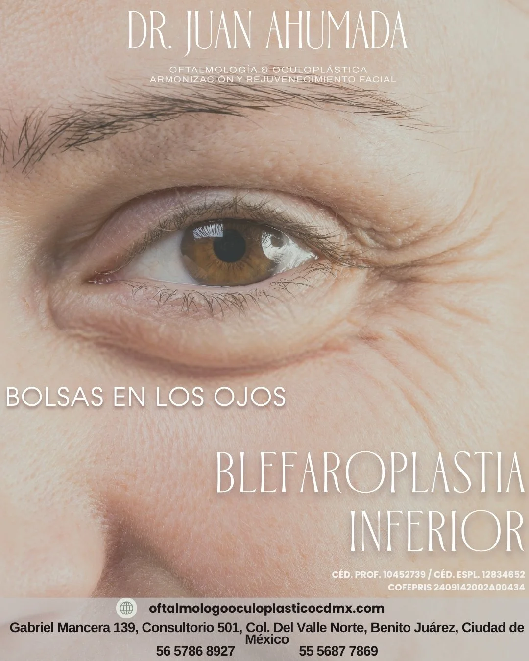 👁️✨ Blefaroplastia inferior: adi&oacute;s a las bolsas y mirada cansada
Elimina el exceso de grasa y mejora la firmeza del p&aacute;rpado inferior.
🔹 Mirada m&aacute;s joven, fresca y natural.
Sin cambiar tu expresi&oacute;n, solo realzando tu bell