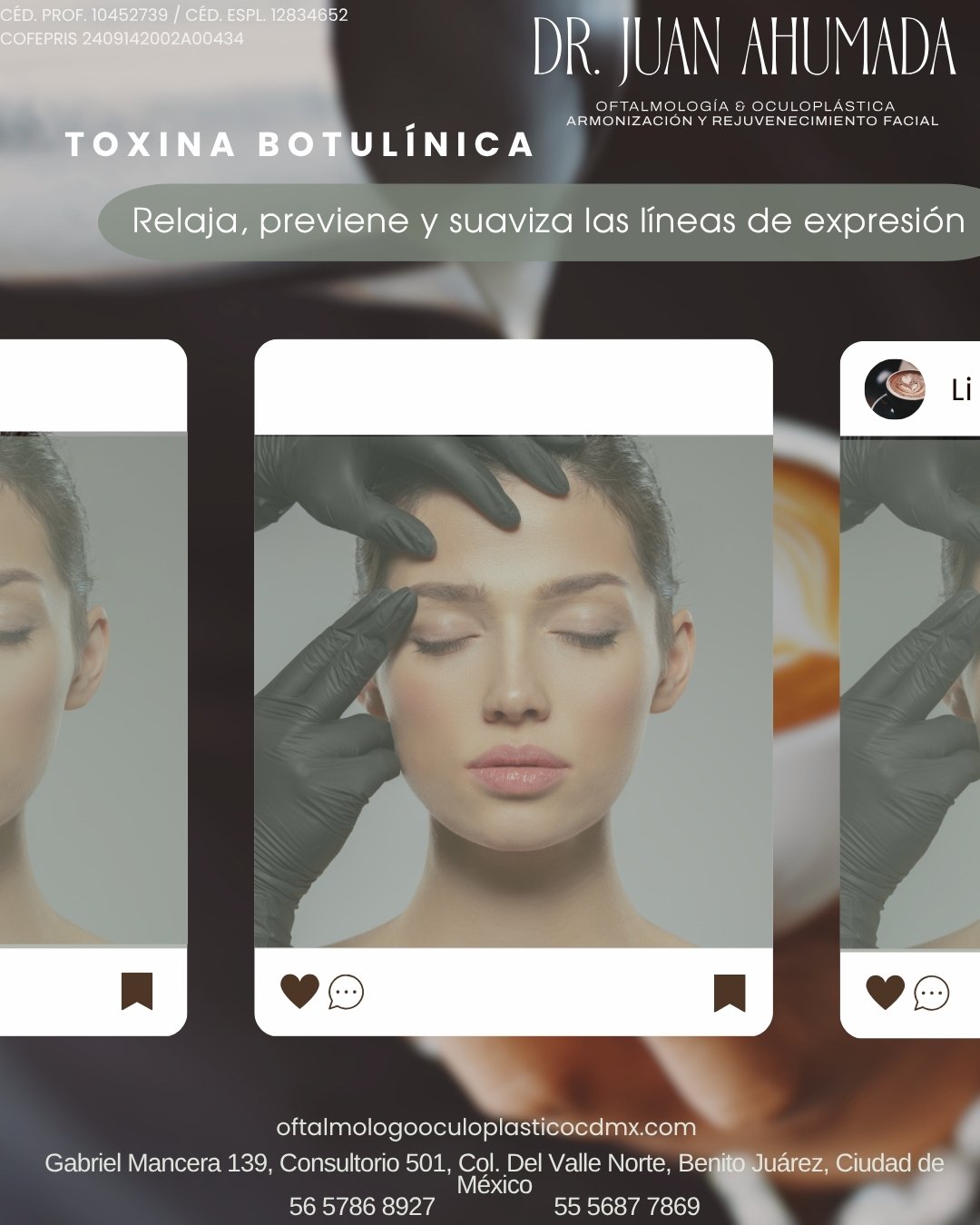 ✨&iquest;L&iacute;neas  de expresi&oacute;n? La soluci&oacute;n est&aacute; aqu&iacute;.✨
Con la toxina botul&iacute;nica suavizamos esas l&iacute;neas que no quieres, sin perder tu naturalidad.�👉 Relaja, previene y rejuvenece tu mirada en minutos.�